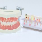 介護士による入れ歯のお手入れ方法や入れ方！義歯を使用している場合の口腔ケア